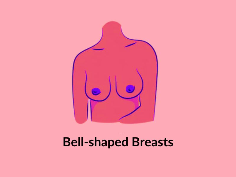 Bell-shaped breasts