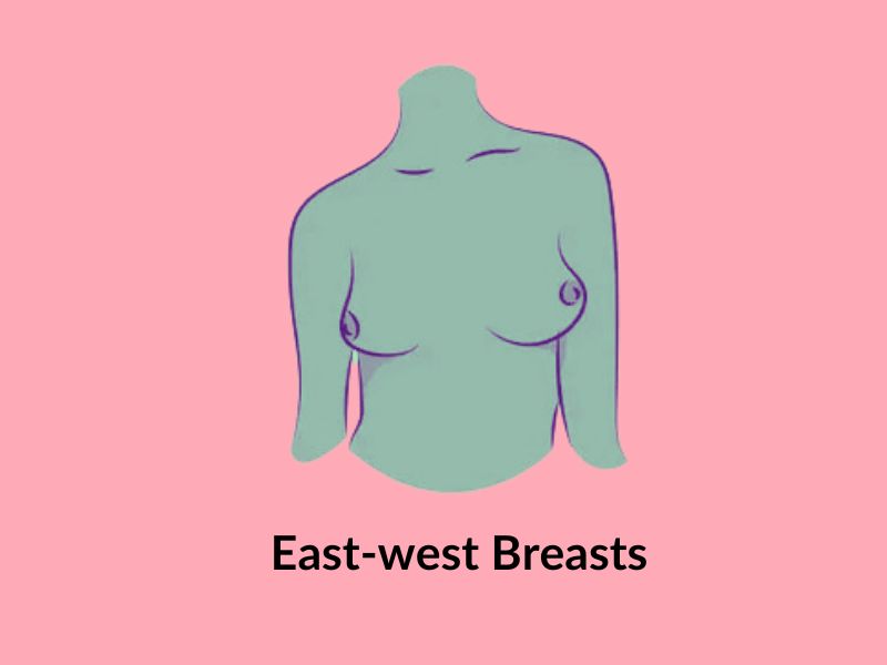 East west breasts