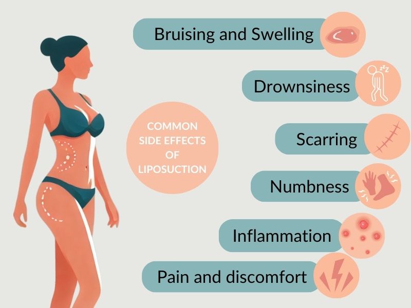 Common Side Effects of Liposuction