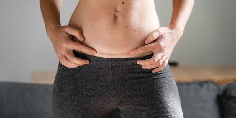 abdominoplasti-riskli-mi Close-up, soft natural lighting captures the lower abdomen of a person with a feminine physique, highlighting a horizontal surgical scar from an abdominoplasty procedure. The individual's hands are gently resting on their hips, pointing towards the scar. They are wearing fitted, dark grey textured leggings. The background is a soft-focus, neutral interior setting. There is no makeup visible as the focus is solely on the torso area. The anatomy depicted shows a natural, post-surgical midsection.