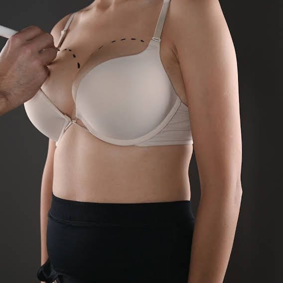 A close-up medical consultation photo features a professional male hand using a black surgical marker to draw pre-operative guidelines on a female patient's chest. The woman wears a plain, light beige push-up bra against a dark, minimalist charcoal background. The lighting is soft and professional, highlighting the contours of the upper body anatomy while maintaining a sterile clinical atmosphere. There is no makeup visible, focusing entirely on the surgical planning and anatomical structure.