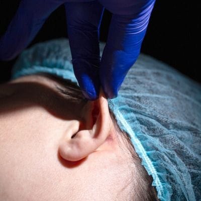 Close-up of a medical procedure on a patient's ear, showing a gloved hand in vibrant blue nitrile adjusting or examining the ear. The patient wears a light blue disposable surgical cap. The lighting is focused and clinical, highlighting the skin texture and anatomy of the earlobe and cartilage. The setting has a dark, minimalist background. No makeup is visible on the natural, fair skin tone. The gender of the patient is ambiguous, and the image emphasizes professional, sterile medical care.