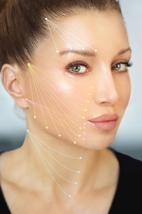 A close-up aesthetic medical portrait featuring a woman with feminine facial features, defined bone structure, and smooth skin. Soft, professional studio lighting illuminates her face, highlighting her naturally enhanced look with minimal, clean makeup. The background is a soft, out-of-focus neutral tone. Anatomical facial points are mapped with delicate, multicolored lines indicating aesthetic lifting or enhancement areas. She is wearing a simple black top, keeping the focus entirely on the facial anatomy and procedural guidelines.