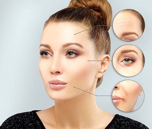 A professional clinical portrait of a woman with distinct feminine features, styled in a sleek high bun and wearing a black sequined top. The lighting is soft and studio-quality, highlighting her smooth skin and well-defined facial anatomy. Three circular insets showcase close-up details of her forehead, eye area, and mouth, indicating areas for potential facial fat grafting treatment. The background is a clean, minimalist light grey, focusing attention entirely on the subject.