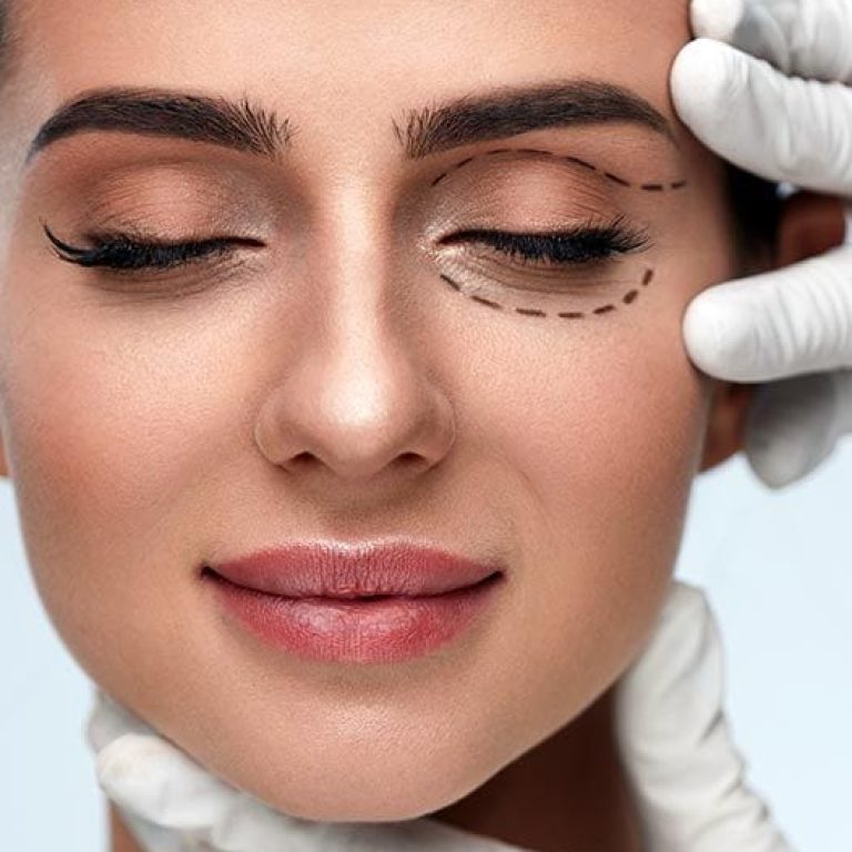 Close-up portrait of a woman with feminine features and natural makeup, including soft eyeshadow and pink lipstick. A plastic surgeon's hands, wearing white medical gloves, are touching her face. Dashed surgical guide lines are drawn around her eye area for a blepharoplasty procedure. The lighting is bright and clinical, highlighting the smooth skin texture and facial anatomy. The background is a clean, solid light blue, and no clothing is visible in the frame.