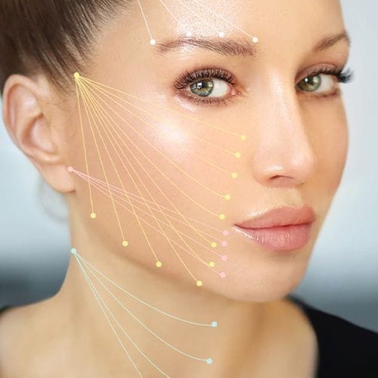 A close-up aesthetic medical portrait featuring a woman with feminine facial features, defined bone structure, and smooth skin. Soft, professional studio lighting illuminates her face, highlighting her naturally enhanced look with minimal, clean makeup. The background is a soft, out-of-focus neutral tone. Anatomical facial points are mapped with delicate, multicolored lines indicating aesthetic lifting or enhancement areas. She is wearing a simple black top, keeping the focus entirely on the facial anatomy and procedural guidelines.