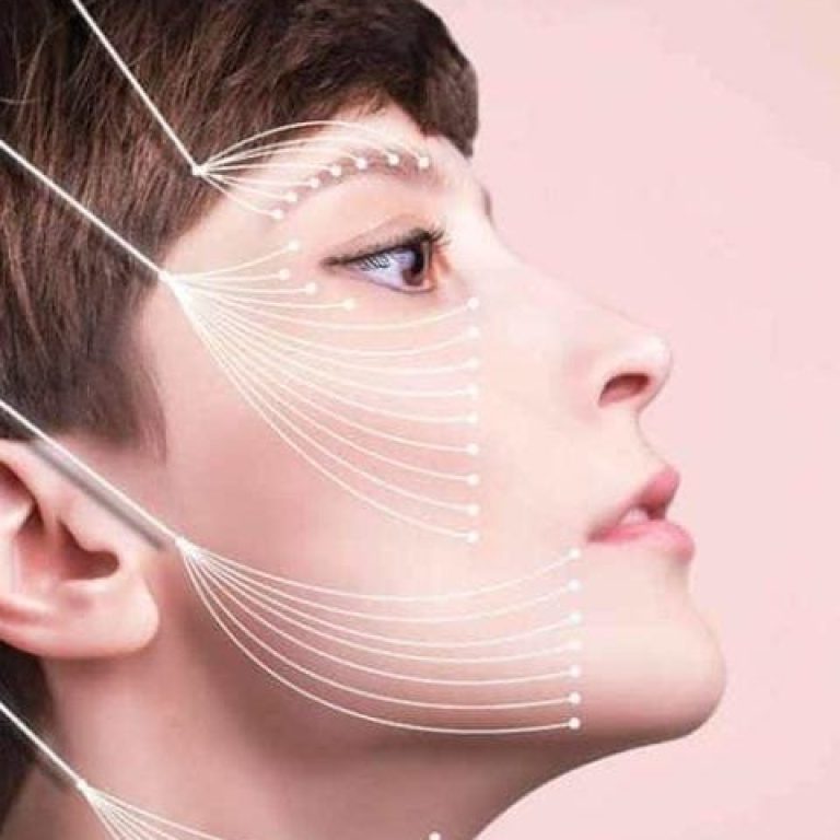 A profile view of a woman's face against a soft, solid pastel pink background, showcasing professional aesthetic treatment mapping. The lighting is bright, even, and clinical, highlighting smooth, clean skin with very subtle, natural makeup focusing on the eye area. The subject displays feminine facial features with a well-defined jawline, nose, and brow structure. The anatomy of the face is emphasized by white graphic lines radiating from multiple points toward the brow, cheeks, jawline, and neck, illustrating threads or aesthetic placement. The subject is wearing no visible clothing, focusing entirely on the head and neck profile.