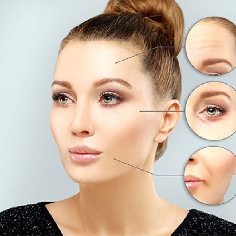 A professional clinical portrait of a woman with distinct feminine features, styled in a sleek high bun and wearing a black sequined top. The lighting is soft and studio-quality, highlighting her smooth skin and well-defined facial anatomy. Three circular insets showcase close-up details of her forehead, eye area, and mouth, indicating areas for potential facial fat grafting treatment. The background is a clean, minimalist light grey, focusing attention entirely on the subject.